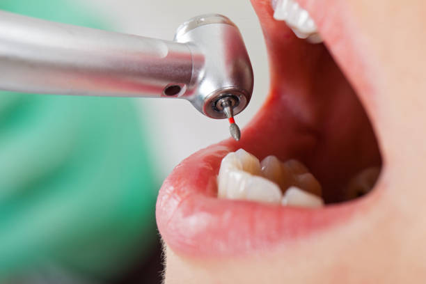Best Mobile Emergency Dentist in Belhaven, NC
